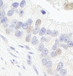 GTF3C1/TFIIIC220 Rabbit anti-Human, Polyclonal, Bethyl Laboratories 100