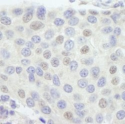 GTF3C1/TFIIIC220 Polyclonal Antibody, Bethyl Laboratories 100 &mu;L; Unconjugated:Antibodies,