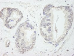 GTF3C1/TFIIIC220 Polyclonal Antibody, Bethyl Laboratories 100 &mu;L; Unconjugated:Antibodies,
