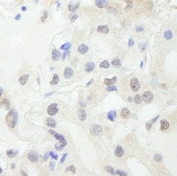 GTF3C1/TFIIIC220 Polyclonal Antibody, Bethyl Laboratories 100 &mu;L; Unconjugated:Antibodies,