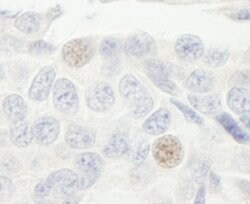 GTF3C2/TFIIIC110 Rabbit anti-Human, Polyclonal, Bethyl Laboratories 10
