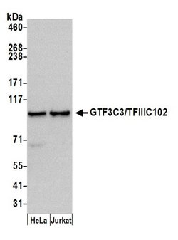 GTF3C3/TFIIIC102 Polyclonal Antibody, Bethyl Laboratories 20 &mu;L; Unconjugated:Antibodies,