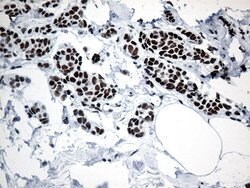 GTF3C4 Monoclonal Antibody (OTI3D4), TrueMAB , OriGene 100 &mu;L | Buy Online | OriGene | Fisher Scientific