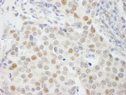 GTF3C4/TFIIIC90 Polyclonal Antibody, Bethyl Laboratories:Antibodies:Primary