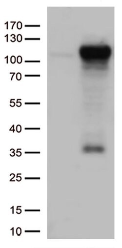 GTF3C4 Monoclonal Antibody (OTI4A3), TrueMAB , OriGene 100 &mu;L; Unconjugated:Antibodies,