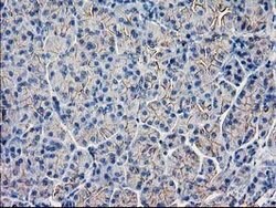 GUK1 Mouse anti-Human, Clone: OTI4A8, lyophilized, TrueMAB 100 &mu;g; Unconjugated:Antibodies,