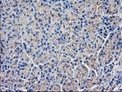 GUK1 Monoclonal Antibody (OTI4A8), TrueMAB , OriGene 100 &mu;L; Unconjugated:Antibodies,
