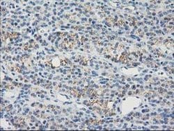 GUK1 Monoclonal Antibody (OTI4A8), TrueMAB , OriGene 100 &mu;L; Unconjugated:Antibodies,