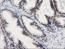 GUK1 Monoclonal Antibody (OTI4A8), TrueMAB , OriGene 100 &mu;L; Unconjugated:Antibodies,