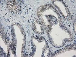 GUK1 Monoclonal Antibody (OTI4A8), TrueMAB , OriGene 100 &mu;L; Unconjugated:Antibodies,