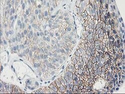 GUK1 Monoclonal Antibody (OTI4A8), TrueMAB , OriGene 100 &mu;L; Unconjugated:Antibodies,