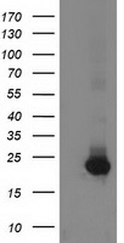 GUK1 Monoclonal Antibody (OTI1D7), TrueMAB , OriGene 100 &mu;L; Unconjugated:Antibodies,