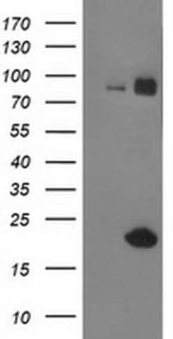 GUK1 Monoclonal Antibody (OTI4A8), TrueMAB , OriGene:Antibodies:Primary