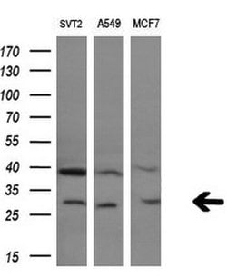 GZMB Monoclonal Antibody (OTI4E4), TrueMAB , OriGene 100 &mu;L; Unconjugated:Antibodies,