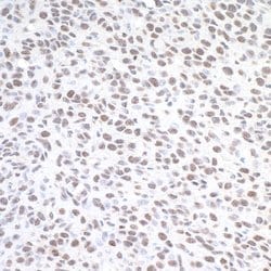 Phospho-gamma-H2AX (Ser139) Rabbit anti-Human, Mouse, Polyclonal, Bethyl