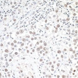 Phospho-gamma-H2AX (Ser139) Rabbit anti-Human, Mouse, Polyclonal, Bethyl