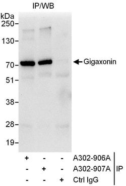 Gigaxonin Rabbit anti-Human, Polyclonal, Bethyl Laboratories 10 &mu;L;
