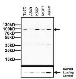 Invitrogen Glucocorticoid Receptor Polyclonal Antibody 50 &mu;g | Buy Online | Invitrogen&trade; | Fisher Scientific