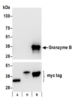 Granzyme B Recombinant Rabbit Monoclonal Antibody (BLR022E), Bethyl Laboratories