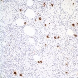 Granzyme B Recombinant Rabbit Monoclonal Antibody (BLR022E), Bethyl Laboratories