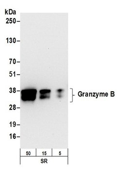 Granzyme B Recombinant Rabbit Monoclonal Antibody (BLR022E), Bethyl Laboratories