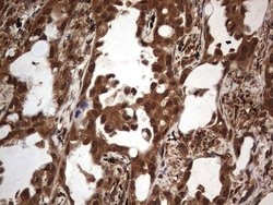 H2AFY2 Monoclonal Antibody (OTI1C2), TrueMAB , OriGene 100 &mu;L; Unconjugated:Antibodies,