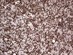 H2AFY2 Monoclonal Antibody (OTI1C2), TrueMAB , OriGene 100 &mu;L; Unconjugated:Antibodies,