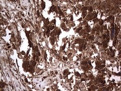 H2AFY2 Monoclonal Antibody (OTI1C2), TrueMAB , OriGene 100 &mu;L; Unconjugated:Antibodies,