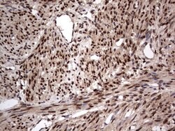 H2AFY2 Monoclonal Antibody (OTI1C2), TrueMAB , OriGene 100 &mu;L; Unconjugated:Antibodies,