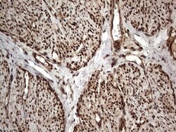 H2AFY2 Monoclonal Antibody (OTI1C2), TrueMAB , OriGene 100 &mu;L; Unconjugated:Antibodies,