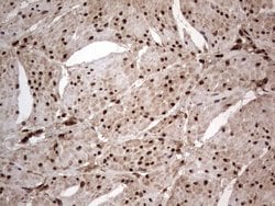 H2AFY2 Monoclonal Antibody (OTI1C2), TrueMAB , OriGene 100 &mu;L; Unconjugated:Antibodies,