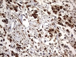 H2AFY2 Mouse anti-Human, Clone: OTI1E9, lyophilized, TrueMAB 100 &mu;g;