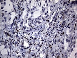 H2AFY2 Monoclonal Antibody (OTI1F5), TrueMAB , OriGene 100 &mu;L; Unconjugated:Antibodies,