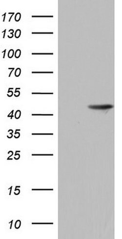 H2AFY2 Monoclonal Antibody (OTI1H1), TrueMAB , OriGene 30 &mu;L | Buy Online | Origene Technologies | Fisher Scientific