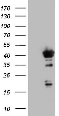 H2AFY2 Monoclonal Antibody (OTI1E1), TrueMAB , OriGene 100 &mu;L; Unconjugated:Antibodies,