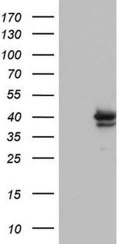 H2AFY2 Monoclonal Antibody (OTI1F6), TrueMAB , OriGene 30 &mu;L; Unconjugated:Antibodies,