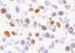 H2AX Polyclonal Antibody, Bethyl Laboratories 100 &mu;L; Unconjugated:Antibodies,