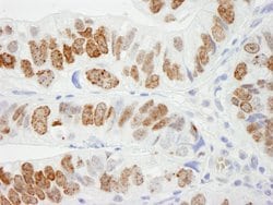 H2AX Polyclonal Antibody, Bethyl Laboratories:Antibodies:Primary Antibodies