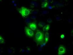 H6PD Mouse anti-Human, Clone: OTI2A7, liquid, TrueMAB 100 &mu;L; Unconjugated:Antibodies,