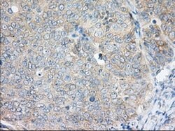 H6PD Monoclonal Antibody (OTI1H6), TrueMAB , OriGene 30 &mu;L; Unconjugated:Antibodies,