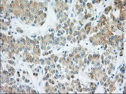 H6PD Monoclonal Antibody (OTI1H6), TrueMAB , OriGene 30 &mu;L; Unconjugated:Antibodies,
