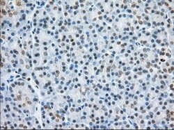 H6PD Mouse anti-Human, Clone: OTI2A7, liquid, TrueMAB 100 &mu;L; Unconjugated:Antibodies,