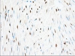 H6PD Mouse anti-Human, Clone: OTI2A7, liquid, TrueMAB 100 &mu;L; Unconjugated:Antibodies,