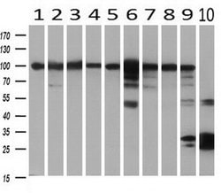 H6PD Mouse anti-Human, Clone: OTI2A7, liquid, TrueMAB 100 &mu;L; Unconjugated:Antibodies,
