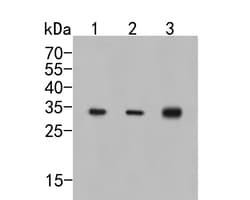 CAPZB Polyclonal Antibody, Huabio 100 &mu;L; Unconjugated:Antibodies, Polyclonal