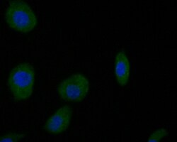 Dopamine Transporter Polyclonal Antibody, Huabio 100 &mu;L; Unconjugated:Antibodies,