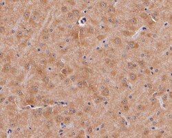 Dopamine Transporter Polyclonal Antibody, Huabio 100 &mu;L; Unconjugated:Antibodies,