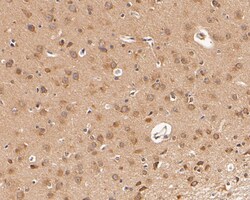 Dopamine Transporter Polyclonal Antibody, Huabio 100 &mu;L; Unconjugated:Antibodies,