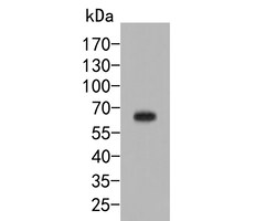 Dopamine Transporter Polyclonal Antibody, Huabio 100 &mu;L; Unconjugated:Antibodies,