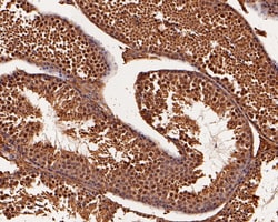 BRCA1 Polyclonal Antibody, Huabio 100 &mu;L; Unconjugated:Antibodies, Polyclonal